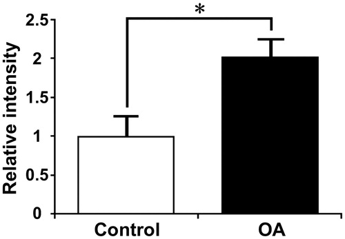 Figure 4. The level of LECT2 in control and OA patient at over 65 years of age. We recalculated expression level of LECT2 in OA and control cartilage by excluding the case of under 65 years of age. LECT2 was increased in OA with a significant difference compared with control (Control n = 3, OA n = 11). *p < 0.05, as determined by Student’s t-test. Error bars indicate SEM.