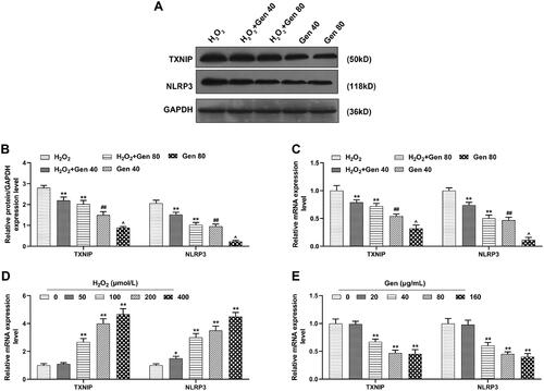 Figure 4. The expression of TXNIP and NLRP3 of H2O2-induced HUVEC was reversed by Gen. (A–C) Effects of 40 and 80 μg/mL Gen on the expression of TXNIP and NLRP3 in HUVECs after 200 μmol/L H2O2 treatment were investigated by quantitative real-time polymerase chain reaction (qRT-PCR) and western blot. GAPDH was used as the internal control. (D) Effects of different concentrations of H2O2 on the expression of TXNIP and NLRP3 in HUVECs was determined by qRT-PCR. GAPDH was used as the internal control. (E) Effects of different concentrations of Gen on the expression of TXNIP and NLRP3 in HUVECs was determined by qRT-PCR. GAPDH was used as the internal control. All experiments were performed in triplicate and the experimental data were expressed as mean ± standard deviation (SD) (*p< 0.05, **p< 0.01, vs. H2O2 or 0 μmol/L H2O2 or 0 μg/mL Gen; ##p< 0.01, vs. H2O2+Gen40; ∧p< 0.05, vs. H2O2+Gen80). HUVECs: human umbilical vein endothelial cells; TXNIP: thioredoxin-interacting protein; NLRP3: nucleotide-binding and oligomerization domain-like receptor 3.