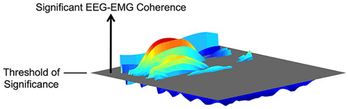 Figure 4. Illustration of the volume of EEG-EMG coherence above the threshold of significance on the frequency-time plane.