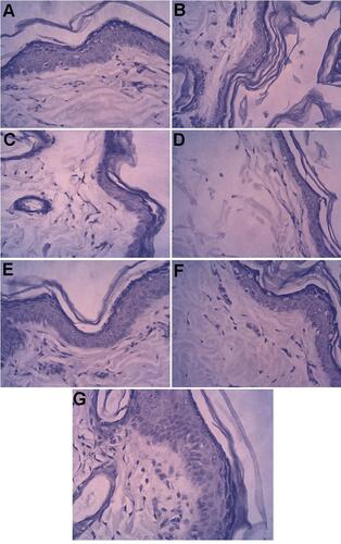 Figure 4 Histopathological microphotographs of different groups of studied rats.