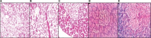 Figure 7 Histopathological section of pancreas.