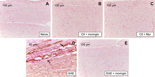 Figure 7 Moringin modulates IL-1β expression in EAE.