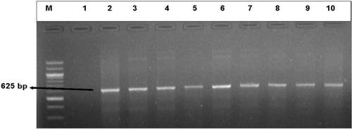 Figure 7 An illustrative gel electrophoresis for the detection of sulII (625 bp) resistance gene. Lane (M) molecular weight marker (100 bp DNA ladder, Thermo scientific), lane 1: negative control, lane 2 to 10: some of the representatives of the genetic expression of sulII (625 bp) from the sulfonamide-resistant DEC and Salmonella isolates.