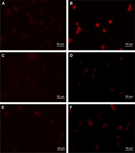 Figure 6 Validation of voltage-gated potassium channels.Notes: Fluorescent staining of the voltage-gated potassium channel proteins (A and B) Kv1.3 and (C and D) Kv7.1 in (A, C, and E) primary monocytes or (B, D, and F) the MM6 cell line with an (E and F) unspecific IgG control. Cells were stained with either rabbit anti-Kv1.3 (3 µg/mL; APC-002; Alomone Labs) or rabbit anti-Kv7.1 (4 µg/mL; AB5932; Millipore) or unspecific rabbit IgG (4 µg/mL; ab27478; Abcam) and goat anti-rabbit IgG (10 µg/mL; A11012; Thermo Fisher Scientific) coupled to Alexa Fluor 594.Abbreviation: IgG, immunoglobulin G.
