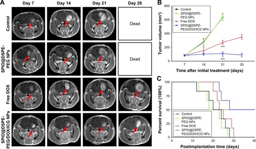 Figure 7 Antitumor efficacy in vivo.Notes: T1-weighted brain MR images of glioma-bearing Wistar rats treated with saline, SPIO@DSPE-PEG NPs, free DOX, and SPIO@DSPE-PEG/DOX/ICG NPs on days 7, 14, 21, and 28 after tumor implantation (A); arrow indicates direction of the glioma. Tumor volumes monitored by MRI (B). Kaplane–Meier survival curves (C) of rats. Data are shown as mean ± SD, n=6. ***P<0.001 vs control group, #P<0.001 vs free DOX group.Abbreviations: DOX, doxorubicin; DSPE-PEG, 1,2-distearoyl-sn-glycero-3-phosphoethanolamine-N-[methoxy(polyethylene glycol)]; ICG, indocyanine green; MR, magnetic resonance; SPIO NPs, superparamagnetic iron oxide nanoparticles.