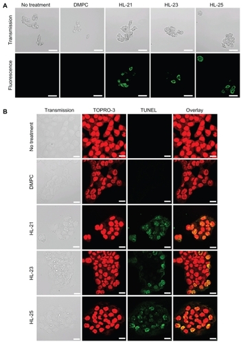 Figure 3 Induction of apoptosis in HCT116 cells by HL-n. (A) Fluorescence micrographs of HCT116 cells stained with FLUOS-conjugated Annexin-V and propidium iodide after the treatment with HL-n (n = 21, 23, 25) for 3 hours. (B) Fluorescence micrographs of HCT116 cells stained with TUNEL and TOPRO-3 after the treatment with HL-n (n = 21, 23, 25) for 48 hours. In both experiments, HCT116 cells were treated with HL-n at the IC50 (DMPC liposomes; [DMPC] = 0.477 mM, HL-21; [DMPC] = 0.190 mM, HL-23; [DMPC] = 0.183 mM, HL-25; [DMPC] = 0.202 mM).Note: Scale bar; 20 μm.Abbreviations: DMPC, dimyristoylphosphatidylcholine; HL, hybrid liposomes; IC50, 50 percent inhibitory concentration.