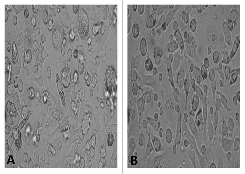 Figure 3. The morphology(×200) under light microscope showed the change of BMDCs. (A) RPMI 1640, (B) NGP.