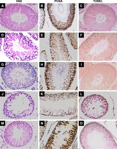Figure 1 Light microscopy results of representative testicular tissue sections from different groups.