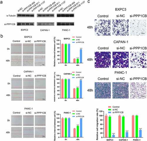 Figure 5. Effects of PPP1CB knockdown on invasion and migration of PAAD cell lines. (a) PPP1CB was knocked down in BXPC3, CAPAN-1, and PANC-1 cells using siRNA: si-NC (non-silencing control), si-PPP1CB-459, si-PPP1CB-911 and si-PPP1CB-1137. Knockdown efficiency was evaluated by Western Blot. (b) PPP1CB knockdown reduces PAAD cell migration. The wound healing assay was performed in BXPC3, CAPAN-1, and PANC-1 cell monolayers for 48 h, and the width of the gap for each group at 0 hours was used as the reference. (c) Invasion analyses of PAAD cells transfected with si-NC, or si-PPP1CB, relative to the invasion in the control group, reported as mean ± SD (n = 3). ***P < 0.001.