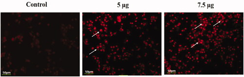 Figure 10. Identification of apoptotic cells by propidium iodide staining. HeLa cells were treated with different concentrations of Hc-CuONPs (5 and 7.5 µg) and then stained with propidium iodide solution. Apoptotic cell death was evaluated by fluorescence microscopy. Viable cells show very mild red fluorescence. Hc-CuONPs treated cells show apoptotic cell death with bright red fluorescence (white arrows).