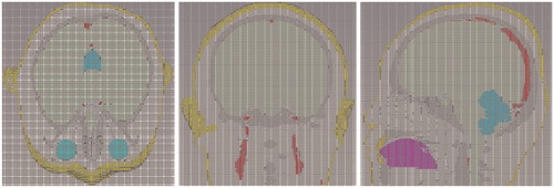 Figure 8. Mesh view of 10-tissue human head in CST.