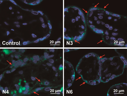 Figure 5. Fluorescence microscopy of placental tissue after 6 h of ex vivo perfusion. Displayed are images from representative placenta perfusion experiments with two amine-modified PS beads (N3 and N4), which showed fluorescent dye leakage, and one amine-modified PS particle representative for an NP without fluorescence leakage (N6). As control placental perfusion without addition of particles was performed. Micrographs show PS beads (green) and DAPI-stained nuclei (blue). Due to autofluorescence, erythrocytes appear also in green. Red arrows indicate accumulated PS beads.