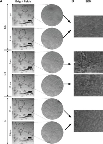 Figure 1 Bright field confocal images of RWM in the x-y-z scanning mode (A). SEM images of RWM (B).Abbreviations: RWM, round window membrane; SEM, scanning electron microscope; OE, outer epithelium layer; CT, connective tissue; IE, inner epithelium layer.