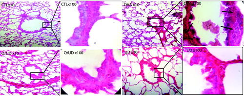 Figure 2. Effect of UD extract on the recruitment of leucocytes in lung tissue. Histological examination of lung tissue was performed 48 h after the final OVA challenge. (Magnification 10× et 100×).