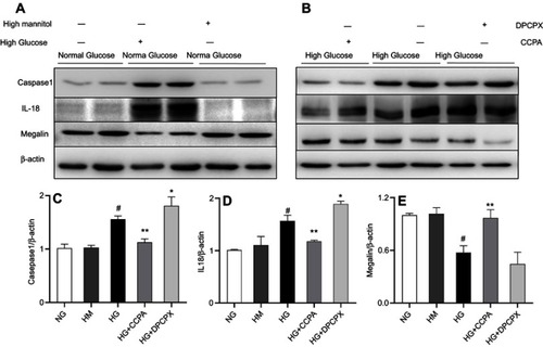 Figure 6 The role of A1AR antagonist DPCPX and agonist CCPA in caspase-1/IL18 activation and megalin loss in HK2 cell cocultured with high glucose. (A–B). Protein expression of caspase-1, IL-18, and megalin in high glucose, high glucose with DPCPX and CCPA by Western blotting. Quantitative analysis of caspase-1 (C), IL-18 (D), and megalin (E). Showed the upregulation of caspase-1/IL-18 and downregulation of megalin expression in high glucose. DPCPX further increased caspase-1/IL-18 expression and decreased megalin expression. However, CCPA inhibited caspase-1/IL-18 expression and improved megalin loss obviously. Data are shown as Mean ± SEM; *P<0.05 HG+DPCPX vs HG, #P<0.01 HG vs NG, **P<0.05 HG+CCPA vs HG. n=4 per group.