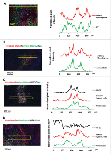 Figure 3. Hypoxia reporter signal co-localizes with hypoxia response markers in mammary tumors. (A) Representative image of GFP MDA-MB-231-5HREODD-mCherry derived tumor frozen tumor sections within normoxic and hypoxic regions relative to the necrotic area (*) (left panel) and the quantification of normalized GFP or mCherry signal in the yellow box (right panel). Green=GFP, normoxia, red=mCherry, hypoxia. (B) Representative image showing mCherry overexpressing cells colocalizing with pimonidazole adduct staining in MDA-MB-231-5HREODD-mCherry derived tumor frozen sections (left panel), and the quantification of average pimonidazole or mCherry signal in the yellow box. Green=pimonidazole, red=mCherry, blue=nuclei. (C) Representative image showing mCherry overexpressing cells correlated with GLUT1 antibody or pimonidazole adduct antibody staining in MDA-MB-231-5HREODD-mCherry derived tumor frozen sections (left panel), and the quantification of average mCherry or GLUT1 or pimonidazole signal in the yellow box (right panel). Green=pimonidazole, red=mCherry, gray=GLUT1, blue=nuclei. (D) Representative image showing mCherry overexpressing hypoxic cells or pimonidazole adduct positive cells adjacent to high HIF1α expressing cells in MDA-MB-231-5HREODD-mCherry derived tumor frozen sections (left panel), and the quantification of average mCherry or pimonidazole or HIF1α signal in the yellow box (right panel). Green=pimonidazole, red=mCherry, gray= HIF1α, blue=nuclei.