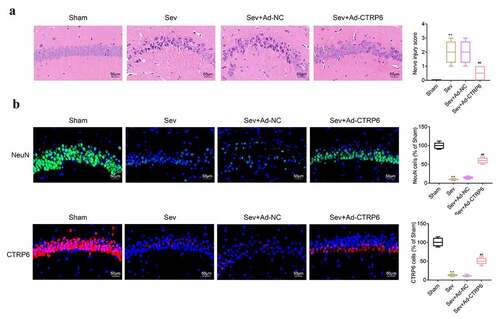 Figure 1. CTRP6 relieved the sevoflurane induced injury of central nervous tissues. (a) H&E staining was performed for the detection of the injury of central nervous tissues. (b) Immunofluorescence assay was performed to detect the expression of CTRP6 and NeuN in these tissues. #p< 0.05, **p< 0.01