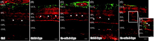 Figure 8. Immunofluorescent staining for glial fibrillary acidic protein (GFAP; green) and the complement anaphylatoxin receptor C5aR (red) in retinal tissue and ARPE cells. Retinal nuclear layers (ONL, INL, and GCL) are indicated. C5aR shows endogenous expression in the retinal tissue, in the inner retina GCL, INL, and the plexiform layers (IPL and OPL). C5aR (indicated by arrowheads) labels Müller cell nuclei (A–D, F). GFAP labels astrocytes (A–E) and major Müller cells in the retinal tissue (A–F). In the cultured gliotic retinas, Müller cells show increased GFAP staining that is more intense after 5 days (D), and GFAP is expressed up to the Müller cells’ distal processes, stretching to the external limiting membrane in the outer retina (indicated by *). Also, GFAP-positive filaments surround the C5aR-positive Müller cell nuclei in the INL (E and F). Scale bars, 20 μM.