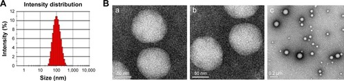Figure 1 (A) Particle size determined by DLS of (DSPE)-PEG2000-RGD-LPs/QCT; (B) transmission electron microscope of (DSPE)-PEG2000-RGD-LPs/QCT (a: day 0; b; 6 months later) (Ba and Bb magnification ×20,000; Bc magnification ×100,000).