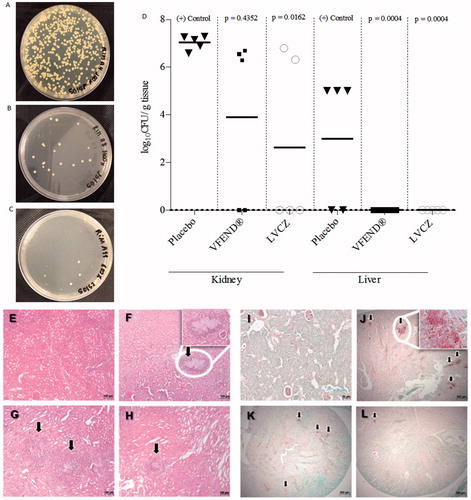 Figure 4. Fungal growth of C. albicans from kidneys of imunossupressed and infected mice treated with placebo (A), VFEND® (B) and LVCZ (C). (D) Effects of the VCZ treatments on the tissue burden of C. albicans in infected mice and controls (n = 5 per group). Infection was completely resolved in the liver using VFEND® or LVCZ formulation. Representative micrographs of histological analysis of H&E stained kidney sections of (E) control group, healthy Balb/C mice, (F) infected mice, placebo group, (G) infected mice, treated with VFEND® and (H) infected mice, treated with LVCZ. PAS stained kidney sections showing fungal invasion in (I) control group, healthy Balb/C mice, (J) infected mice, placebo group, (K) infected mice, treated with VFEND® and (L) infected mice, treated with LVCZ. Inserts are higher magnification of fungal invasion areas in the kidney tissue, also indicated by black arrows.