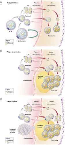 Figure 1. Elevated triglyceride-rich lipoproteins and atherosclerotic plaque initiation, plaque progression and plaque rupture causing myocardial infarction or ischemic stroke.These images depict a nonfasting or postprandial state with lipoprotein in plasma of both intestinal (chylomicrons and chylomicron remnants) and hepatic origin (VLDL, VLDL remnants = intermediate-density lipoproteins) and LDL. LDLs and remnants cross the endothelial layer of intima in a process dependent on blood pressure, lipoprotein size and lipoprotein concentration, possibly involving transcytosis.Modified with permission from [Citation10].