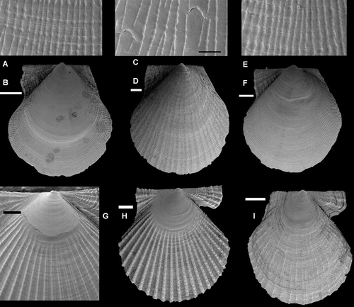Figure 11.  Young specimens of Pectinidae. Scale lines A, C, E, 50 µm, others 500 µm. (A,B) Palliolum incomparabile, Sweden, Bohuslän, Koster area, depth 35 m (SMNH 55523). (C,D) Palliolum striatum, western Norway, Korsfjord, depth 300–200 m (SMNH 19999). (E,F) Palliolum tigerinum, western Norway, Raunefjord, depth 65–70 m (SMNH 20064). (G) Aequipecten opercularis, western Norway, Raunefjord, depth 12–7 m (SMNH 20511). (H) Aequipecten opercularis, Italy, Sicily, Brucoli, depth 20 m (SMNH 56412). (I) Chlamys islandica, BIOICE#2537, off northwestern Iceland, depth 44 m (SMNH 55503).
