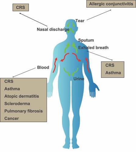 Figure 4. Body fluids and periostin. Periostin is detected in many body fluids, including blood, and these samples can be used to detect periostin as a biomarker for many diseases. In case of CRS, periostin can be detected in nasal discharge, sputum, and exhaled breath condensate, in addition to blood.