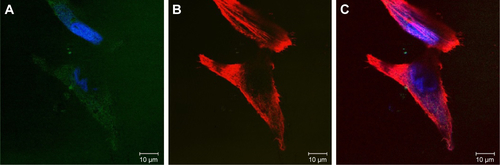 Figure S2 Confocal microscopy photograph of cells treated with H2O2.Notes: (A) Annexin V-Alexa Fluor 488 was used to indicate PS, shown in green; DAPI was used to stain nuclei, shown in blue; (B)Texas Red-X phalloidin was used to label cytoskeletal F-actin, shown in red; and (C) superimposition of (A) and (B).Abbreviations: PS, phosphatidylserine; DAPI, 4′,6-diamidino-2-phenylindole.