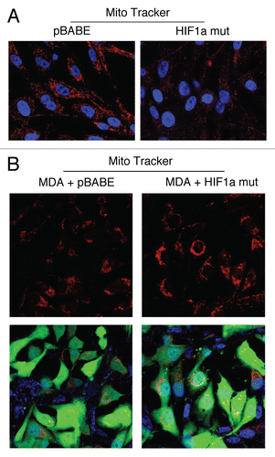 Figure 8 Fibroblasts harboring activated HIF1a promote mitochondrial activity in adjacent cancer cells. MitoTracker is used to visualize functional mitochondria with an active membrane potential. (A) Fibroblasts alone. Note that fibroblasts harboring activated HIF1a show reduced MitoTracker staining, consistent with a decrease in mitochondrial mass and/or membrane potential. (B) Co-culture. Note that fibroblasts harboring activated HIF1a increase the MitoTracker staining profile of adjacent MDA-MB-231 cancer cells, when they are co-cultured. MDA-MB-231 breast cancer cells are marked by GFP expression.