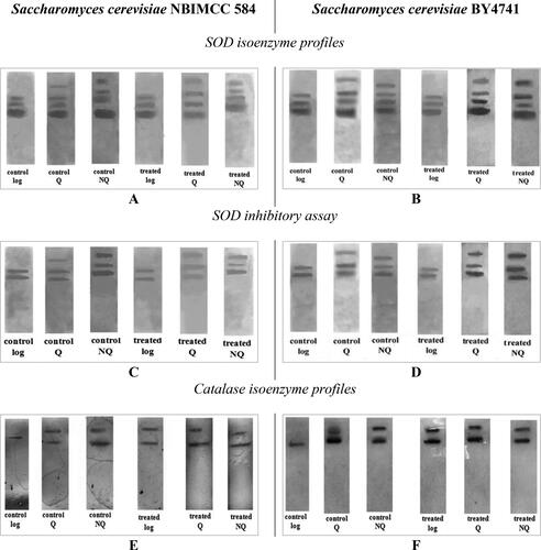 Figure 6. Electrophoretic profiles of SOD (A, B); SOD inhibitory analysis with 2 mmol/L KCN (C, D); electrophoretic profiles of catalase enzymes of S. cerevisiae (E, F) in control and in threated with 100 µmol/L Cd(NO3)2 cells.