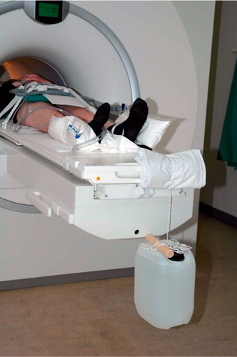 Figure 12. MRI and traction device that pulled the leg distally with a load of 10 kg.