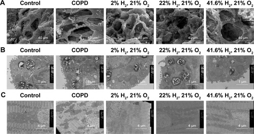 Figure 4 Effect of hydrogen on changes in the ultrastructure of COPD-like lung disease rats.