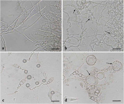 Fig. 3 (Colour online) Effects of culture filtrates of B. subtilis BJ-1 on mycelial morphology, conidial germination and appressorial formation of M. oryzae strain P131. a, Mycelia of M. oryzae without culture filtrate of BJ-1 (CK). b, Mycelia of M. oryzae treated with 0.5% culture filtrate of BJ-1. Arrows indicate abnormal hyphal fragments. c, Conidial germination and appressorial formation without culture filtrate of BJ-1 (CK). d, Malformation of germ tubes with 0.5% culture filtrate of BJ-1. Arrows indicate bulbous germ tubes. Bar = 10 µm.