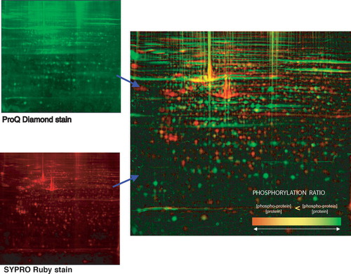 Figure 2.  Demonstration of the specific detection of phosphoproteins (by Pro-Q® Diamond staining) and total protein detection (by SYPRO Ruby staining) of a 2-D PAGE gel of cultured fibroblasts (B. Franzén, unpublished).