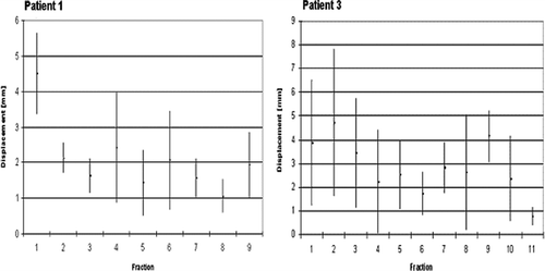 Figure 5.  Intrafractional average marker displacement±SD and interfractional variation of on target verification for all fractions for patient 1 with a lung and patient 3 with a liver tumor.