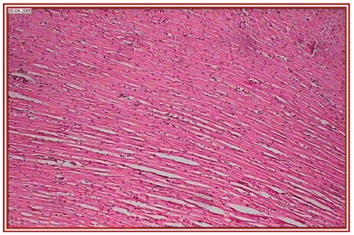Figure 6.  STZ + ethanol extract of Embelia ribes + ISO treated group (i.e., group VI) rat heart section, showing normal myocardial fibers (×10).