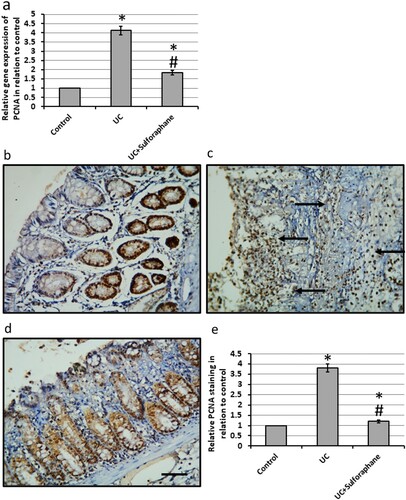 Figure 8. Effect of ulcerative colitis (UC) and 15 mg/kg sulforaphane on gene expression of proliferating cell nuclear antigen (PCNA, a) as well colon sections stained with anti-PCNA antibodies in control group (b), UC group (c) and UC group treated with sulforaphane (d). Immunohistochemistry score of positive staining (e). *Significant difference as compared with control group at p < .05. #Significant difference as compared with UC group at p < .05. The micro-images represented the results of examining three rats in each group with examination of 10 fields in each rat.