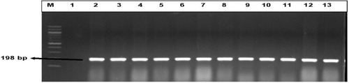 Figure 3 Gel electrophoresis representation of β-Lactam resistance genes ampC (198 bp) detected in DEC and Salmonella isolates. Lane (M) Molecular weight marker (100 bp DNA ladder, Thermo Scientific), lane 1: negative control, lane 2 to 13: some of the representatives of the genetic expression of ampC (198 bp) from the β- Lactams -resistant DEC and Salmonella isolates.