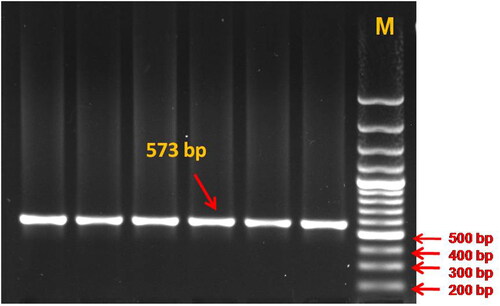 Figure 1. PCR amplification of TLR4 gene fragment spanning 5’ UTR, exon 1 and partial intron 1 region (573 bp), resolved on 1.5% agarose gel (M – Molecular weight marker = 100 bp).