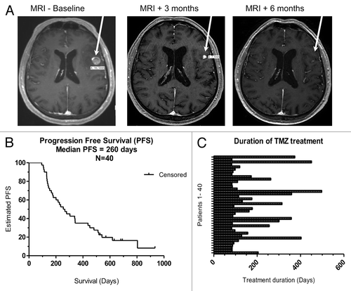 Figure 1. Clinical efficacy and overall survival of melanoma patients treated with temolozomide. (A) Magnetic resonance imaging (MRI) scans from a patient undergoing a partial response and demonstrating an almost complete response in a brain lesion after 6 mo of temolozomide (TMZ) treatment. (B) Kaplan-Meier plot of progression-free survival (PFS) for all patients included in this study (n = 40). Median PFS was 260 d. PFS was defined as the time intervening between the first dose of TMZ until disease progression or death from any cause. When no progression or death occurred, data were censored at the date of last adequate disease assessment. (C) Duration of TMZ treatment for all enrolled patients. The duration of treatment was defined as time intervening between the first and the last dose of TMZ. The mean treatment duration was 173 d (95% CI = 135.4–210.3), corresponding to ~5 cycles of TMZ treatment.