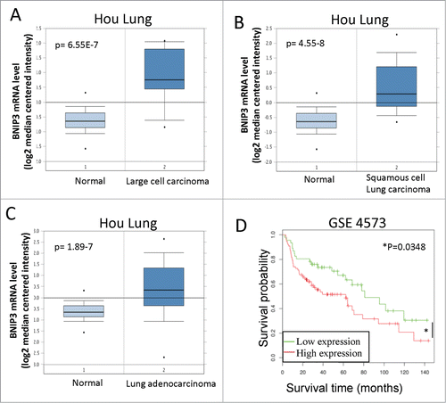 Figure 4. BNIP3 expression is increased in lung carcinomas and correlates with worse patient survival. (A) BNIP3 expression in normal lung and large cell carcinoma, Hou Lung dataset. (B) BNIP3 expression in normal lung and squamous cell lung carcinoma, Hou Lung data set. (C) BNIP3 expression in normal lung and lung adenocarcinoma, Hou Lung dataset. (A–C) n = 156 samples in th Hou Lung data set. (D) Survival analysis of GSE 4573 dataset (patients with lung cancer). Patients were divided in 2 groups: patients with low expression of the BNIP3 gene and with high expression. n = 46 patients with low BNIP3 expression, n = 77 patients with high BNIP3 expression.