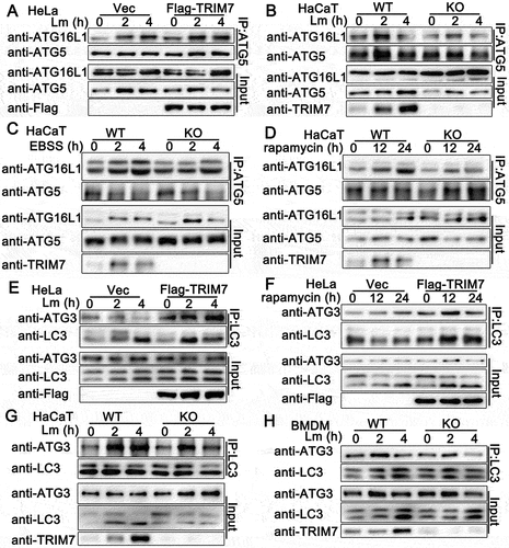 Figure 6. TRIM7 regulated ATG7-related ubiquitin-like conjugation systems in autophagy. (A) HeLa cells were transfected with Vector (Vec) or Flag-TRIM7, and then infected with Lm (MOI = 10) for indicated time periods. Afterward, the cell lysates were subjected to immunoprecipitation (IP) and immunoblot (IB) analysis as indicated. (B) Wild-type (WT) and TRIM7-deficient (KO) HaCaT cells were infected with Lm (MOI = 10) for indicated time periods. Afterward, the cell lysates were subjected to immunoprecipitation (IP) and immunoblot (IB) analysis as indicated. (C, D) Wild-type (WT) and TRIM7-deficient (KO) HaCaT cells were treated with EBSS (C) or rapamycin (D) for indicated time periods. Afterward, the cell lysates were subjected to immunoprecipitation (IP) and immunoblot (IB) analysis as indicated. (E) HeLa cells were transfected with Vector (Vec) or TRIM7-encoding plasmids, and were infected with Lm (MOI = 10) for indicated time periods. Afterward, the cell lysates were subjected to immunoprecipitation (IP) and immunoblot (IB) analysis as indicated. (F) HeLa cells were transfected with Vector (Vec) or Flag-TRIM7, and then treated with rapamycin for indicated time periods. Afterward, the cell lysates were subjected to immunoprecipitation (IP) and immunoblot (IB) analysis as indicated. (G, H) Wild-type (WT) and TRIM7-deficient (KO) HaCaT cells (G) or BMDMs (H) were infected with Lm (MOI = 10) for indicated time periods. Afterward, the cell lysates were subjected to immunoprecipitation (IP) and immunoblot (IB) analysis as indicated. The data are representative of three independent experiments.