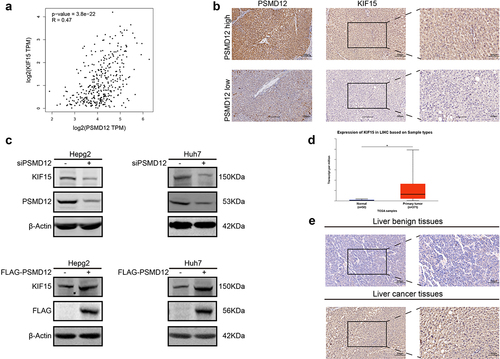 Figure 5. PSMD regulates the expression of KIF15 in liver cancer cells. (a) Correlation analysis of mRNA expression of KIF15 and PSMD12 in TCGA database. (b) Immunohistochemistry staining of KIF15 in liver cancer tissues with high/low expression of PSMD12. (c) Levels of KIF15 proteins in PSMD12 knockdown and PSMD12-overexpressing cells through PSMD12 siRNA and overexpression plasmids were detected by western blot analysis. (d) KIF15 was highly expressed in liver cancer tissues (N = 371) compared with normal liver tissues (N = 50) according to analysis of data from TCGA database. (e) Expression of KIF15 in liver cancer tissues and normal tissues by immunohistochemistry (magnification ×200).