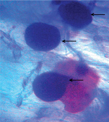 Figure 3. Microscopic view showing the formation of clamdospore in the cortical section of root tissue (arrow indicates the clamdospore formation inside the cortex region of root section).