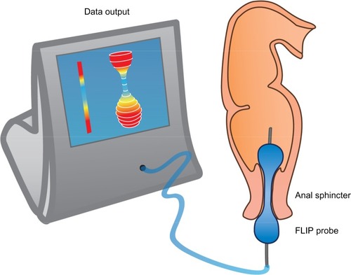 Figure 3 The FLIP probe.