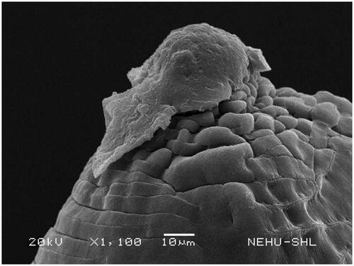 Figure 11. Tail end of A. perspicillum treated with A. oleracea extract. The cuticle is severely shrunk and folded. The pointed tail is deformed.