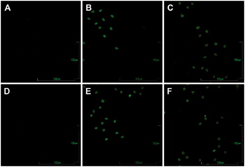 Figure 3. Determination of DNA fragmentation in MDA-MB231 cells treated with MDE by the TUNEL assay. Cells incubated with DMSO 0.01% for 24 h (A) and 48 h (D), cisplatin (CDDP) 2.9 μg/ml, as the positive control of apoptosis, for 24 h (B) and 48 h (E) or MDE 25 μg/ml for 24 h (C) and 48 h (F). Cells were subjected to the TUNEL assay. All photographs are shown at 20 × magnification. Results represent three independent experiments in duplicate.