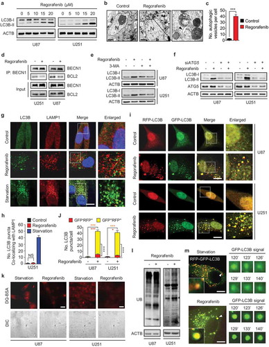 Figure 2. Regorafenib induces autophagy initiation and blocks autophagosome-lysosome fusion in GBM cells. (a) Immunoblotting analysis of LC3B expression in GBM cells treated with indicated concentrations of regorafenib for 24 h. (b) Autophagic vesicles detected by transmission electron microscope in U87 cells treated with or without 20 μM regorafenib for 24 h. Scale bar: 2 μm. N, nucleus. Arrows, autophagic vesicles. (c) The amount of autophagic vesicles in (b). (d) Co-immunoprecipitation analysis of the interaction between BECN 1 and BCL2 in GBM cells treated with or without 20 μM regorafenib for 24 h. (e) Immunoblotting analysis of LC3B expression in GBM cells treated with or without 20 μM regorafenib in the presence or absence of 5 mM 3-MA for 24 h. (f) Immunoblotting analysis of LC3B expression in GBM cells transfected with siScramble or siATG5 for 24 h, followed by treatment with or without 20 μM regorafenib for another 24 h. (g) Immunofluorescence analysis of the colocalization of endogenous LC3B and LAMP1 in U251 cells treated with or without 20 μM regorafenib for 24 h. Cells were incubated with serum- and glucose-free medium (starvation) for 2 h as positive control. Scale bar: 10 μm. (h) The amount of co-localized puncta of LC3B and LAMP1 in (g). (i) Immunofluorescence analysis of cells transiently transfected with tandem mRFP-GFP-tagged LC3B and treated with or without 20 μM regorafenib for 24 h. Scale bar: 10 μm. (j) Quantification of the ratio of red puncta indicating AL (autolysosome) versus yellow puncta indicating AP (autophagosome) in (i). (k) Representative images of GBM cells incubated with BODIPY-conjugated bovine serum (DQ-BSA, red) for 1 h and followed by 20 μM regorafenib treatment for 24 h, or incubation with serum- and glucose-free medium (starvation). Scale bar: 20 μm. (l) Immunoblotting analysis of ubiquitinated proteins in GBM cells treated with or without 20 μM regorafenib for 24 h. (m) U87 cells transfected with tandem mRFP-GFP-tagged LC3B for 24 h were subjected to live-cell microscopy. Small panels show the life time of the GFP-LC3B signal indicated by an arrow in the whole cell image. Times represents minutes post glucose- and serum-starvation or 20 μM regorafenib treatment for 2 h. Scale bar: 5 μm. Data are means ± s.d. and are representative of 3 independent experiments. *P < 0.05, **P < 0.01; ***P < 0.001.