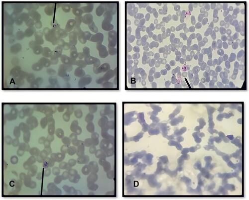 Figure 2 The presence of Plasmodium spp. identified using Giemsa stain on day 1, 7 and 14. (A) Several ring form of Plasmodium falciparum characteristic by acole form from day 1; (B) Amoeboid form of Plasmodium vivax from day 7; (C) Viable trophozoite of Plasmodium falciparum characteristic by ring form with tick cytoplasm and Maurer’s dot from day 14; (D) On day 21 no parasite was found. All the parasites show normal morphology characterized by regular nucleus, normal cytoplasmic volume and no halo formation representing live parasite.