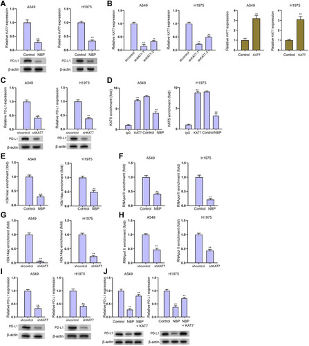 Figure 5 NBP suppresses PD-L1 expression in lung cancer cells through targeting KAT7. (A) The expression of KAT7 was analyzed by qPCR in A549 and H1975 cells treated with NBP. (B) The expression of KAT7 was determined by qPCR in A549 and H1975 cells treated with KAT7 shRNAs. (C) The expression of PD-L1 was determined by qPCR in A549 and H1975 cells treated with KAT7 shRNA. (D–F) The A549 and H1975 were cells treated with NBP. The enrichment of KAT7 (D), H3K14ac (E), and RNA pol II (F) on PD-L1 promoter was analyzed by ChIP assays. (G–I) The A549 and H1975 were cells treated with NBP. The enrichment of KAT7 (G) and H3K14ac (H), on PD-L1 promoter was analyzed by ChIP assays. (I) The expression of PD-L1 was determined by qPCR. (J) The expression of PD-L1 was detected by qPCR in A549 and H1975 cells treated with NBP or co-treated with NBP and KAT7 overexpressing plasmid. mean ± SD. **P < 0.01.
